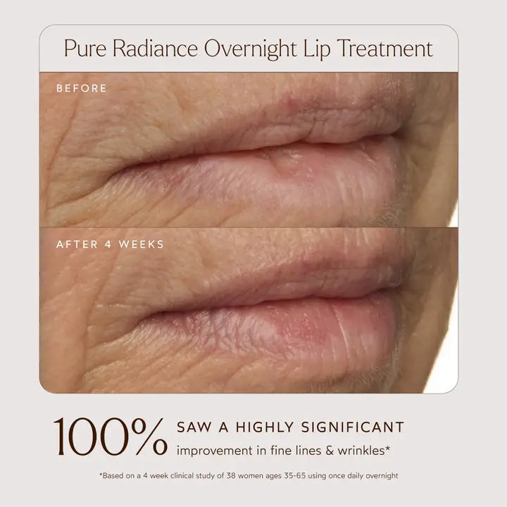 Overnight Lip Treatment